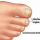 Comment traiter la mycose des ongles de pied naturellement ?